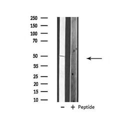 Invitrogen VANGL1 Polyclonal Antibody 100 &mu;L; Unconjugated:Antibodies,