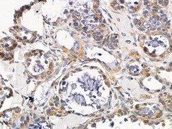 Invitrogen VTI1A Polyclonal Antibody 100 &mu;L; Unconjugated:Antibodies,