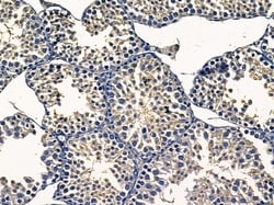 Invitrogen VTI1A Polyclonal Antibody 100 &mu;L; Unconjugated:Antibodies,