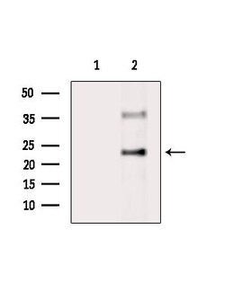 Invitrogen VTI1A Polyclonal Antibody 100 &mu;L; Unconjugated:Antibodies,