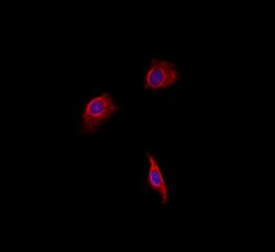 Invitrogen WAVE2 Polyclonal Antibody 100 &mu;L; Unconjugated:Antibodies,