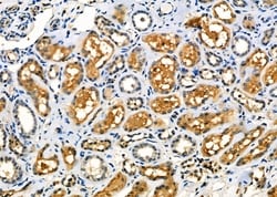 Invitrogen WAVE2 Polyclonal Antibody 100 &mu;L; Unconjugated:Antibodies,