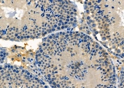 Invitrogen WAVE2 Polyclonal Antibody 100 &mu;L; Unconjugated:Antibodies,