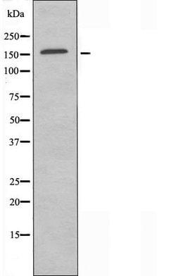 Invitrogen ZNF592 Polyclonal Antibody 100 &mu;L | Buy Online | Invitrogen&trade; | Fisher Scientific