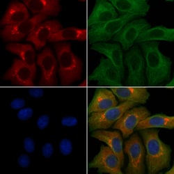 Invitrogen SLC39A9 Polyclonal Antibody 100 &mu;L; Unconjugated:Antibodies,