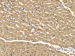 Invitrogen SLC39A9 Polyclonal Antibody 100 &mu;L; Unconjugated:Antibodies,