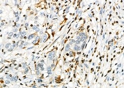 Invitrogen PTGR2 Polyclonal Antibody 100 &mu;L | Buy Online | Invitrogen&trade; | Fisher Scientific