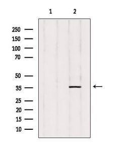 Invitrogen PTGR2 Polyclonal Antibody 100 &mu;L | Buy Online | Invitrogen&trade; | Fisher Scientific