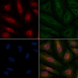 Invitrogen RAD51C Polyclonal Antibody 100 &mu;L; Unconjugated:Antibodies,