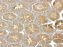 Invitrogen RAD51C Polyclonal Antibody 100 &mu;L; Unconjugated:Antibodies,