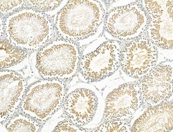 Invitrogen RAD51C Polyclonal Antibody 100 &mu;L; Unconjugated:Antibodies,