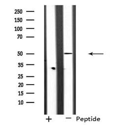 Invitrogen RAD51C Polyclonal Antibody 100 &mu;L; Unconjugated:Antibodies,