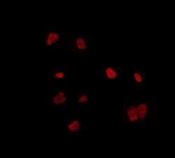 Invitrogen RALY Polyclonal Antibody 100 &mu;L | Buy Online | Invitrogen&trade; | Fisher Scientific