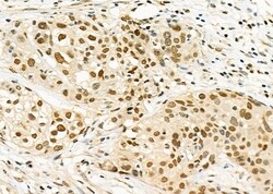 Invitrogen RALY Polyclonal Antibody 100 &mu;L | Buy Online | Invitrogen&trade; | Fisher Scientific