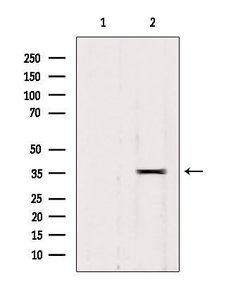 Invitrogen RALY Polyclonal Antibody 100 &mu;L | Buy Online | Invitrogen&trade; | Fisher Scientific