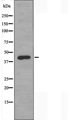 Invitrogen TBPL2 Polyclonal Antibody 100 &mu;L; Unconjugated:Antibodies,
