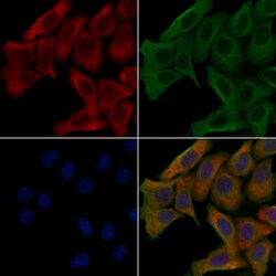 PPFIBP1 Polyclonal Antibody:Antibodies, Polyclonal
