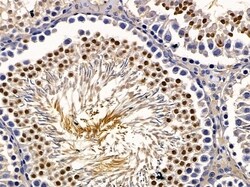 Invitrogen ZNF575 Polyclonal Antibody 100 &mu;L; Unconjugated:Antibodies,