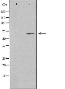 Invitrogen EME1 Polyclonal Antibody 100 &mu;L | Buy Online | Invitrogen&trade; | Fisher Scientific