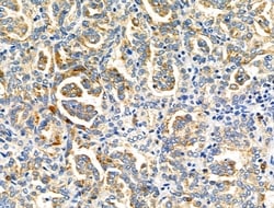 Invitrogen NDFIP1 Polyclonal Antibody 100 &mu;L; Unconjugated:Antibodies,