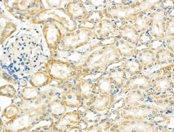 Invitrogen NDFIP1 Polyclonal Antibody 100 &mu;L; Unconjugated:Antibodies,