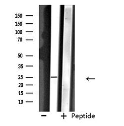 Invitrogen NDFIP1 Polyclonal Antibody 100 &mu;L; Unconjugated:Antibodies,