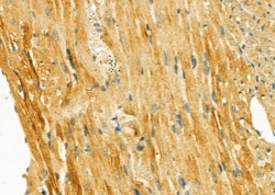Invitrogen GNE Polyclonal Antibody 100 &mu;L | Buy Online | Invitrogen&trade; | Fisher Scientific