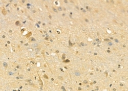 Invitrogen GNE Polyclonal Antibody 100 &mu;L | Buy Online | Invitrogen&trade; | Fisher Scientific