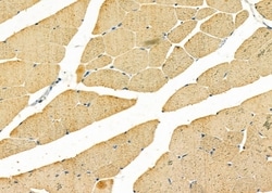 Invitrogen GNE Polyclonal Antibody 100 &mu;L | Buy Online | Invitrogen&trade; | Fisher Scientific