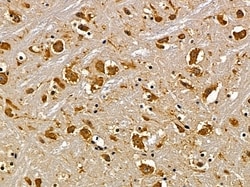 Invitrogen SLC30A9 Polyclonal Antibody 100 &mu;L; Unconjugated:Antibodies,