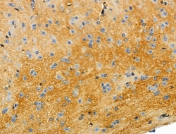 Invitrogen Cytochrome C1 Polyclonal Antibody 100 &mu;L; Unconjugated:Antibodies,