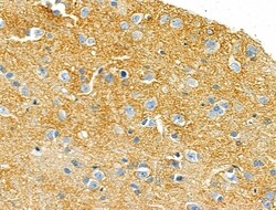 Invitrogen Cytochrome C1 Polyclonal Antibody 100 &mu;L; Unconjugated:Antibodies,