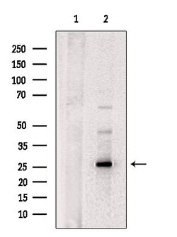 Invitrogen FGF13 Polyclonal Antibody 100 &mu;L; Unconjugated:Antibodies,