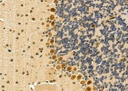 Invitrogen IL11RA Polyclonal Antibody 100 &mu;L; Unconjugated:Antibodies,