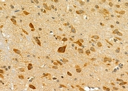 Invitrogen IL11RA Polyclonal Antibody 100 &mu;L; Unconjugated:Antibodies,