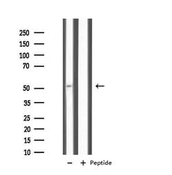 Invitrogen IL11RA Polyclonal Antibody 100 &mu;L; Unconjugated:Antibodies,