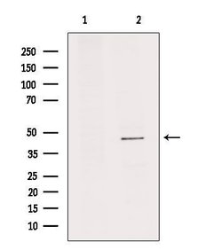 Invitrogen IL11RA Polyclonal Antibody 100 &mu;L; Unconjugated:Antibodies,