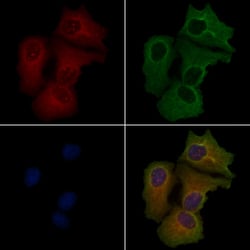 Invitrogen IL15RA Polyclonal Antibody 100 &mu;L; Unconjugated:Antikörper