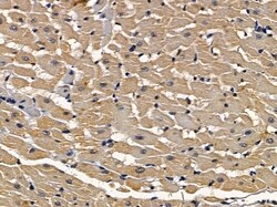 Invitrogen IL15RA Polyclonal Antibody 100 &mu;L; Unconjugated:Antikörper
