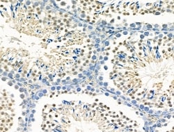 Invitrogen MX2 Polyclonal Antibody 100 &mu;L; Unconjugated:Antibodies,