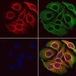 Invitrogen PLCB2 Polyclonal Antibody 100 &mu;L; Unconjugated:Antibodies,