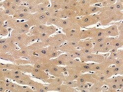 Invitrogen SNIP Polyclonal Antibody 100 &mu;L; Unconjugated:Antibodies,