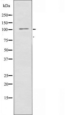Invitrogen SNIP Polyclonal Antibody 100 &mu;L; Unconjugated:Antibodies,