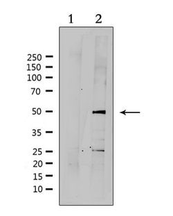 Invitrogen SUV39H2 Polyclonal Antibody 100 &mu;L; Unconjugated:Antibodies,