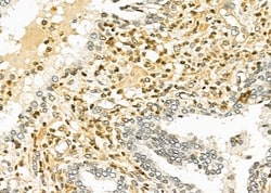 Invitrogen TAIP2 Polyclonal Antibody 100 &mu;L; Unconjugated:Antibodies,