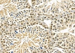 Invitrogen TAIP2 Polyclonal Antibody 100 &mu;L; Unconjugated:Antibodies,