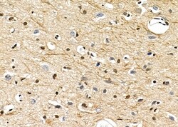 Invitrogen TAIP2 Polyclonal Antibody 100 &mu;L; Unconjugated:Antibodies,