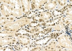 Invitrogen TAIP2 Polyclonal Antibody 100 &mu;L; Unconjugated:Antibodies,