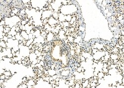 Invitrogen TAIP2 Polyclonal Antibody 100 &mu;L; Unconjugated:Antibodies,