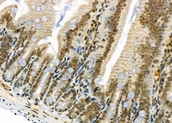 Invitrogen TAIP2 Polyclonal Antibody 100 &mu;L; Unconjugated:Antibodies,